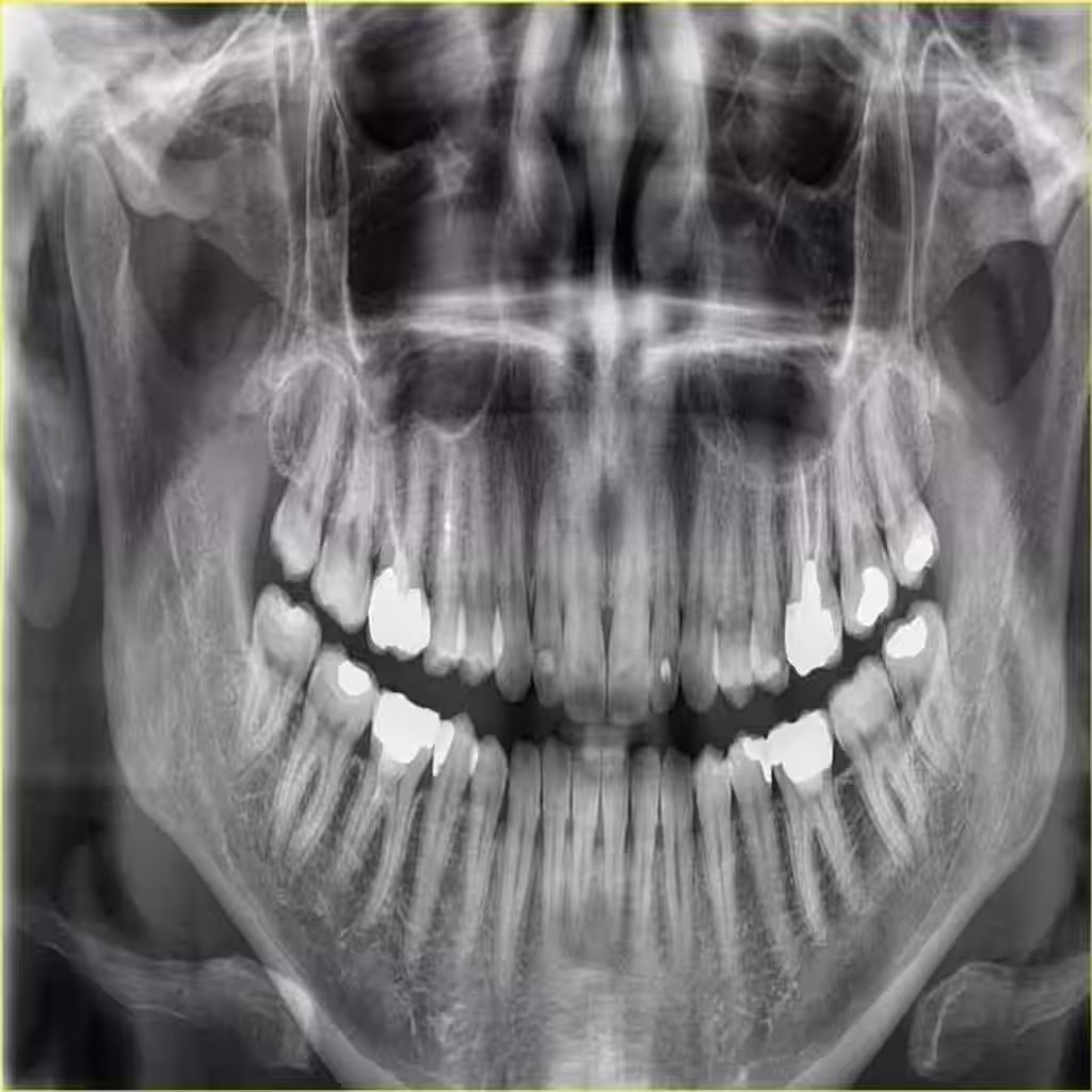 Teeth X-Ray